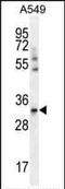 ADP/ATP translocase 3 antibody, PA5-35113, Invitrogen Antibodies, Western Blot image 