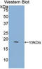 Heparin Binding EGF Like Growth Factor antibody, LS-C294471, Lifespan Biosciences, Western Blot image 