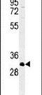 ATPase H+/K+ Transporting Subunit Beta antibody, PA5-25105, Invitrogen Antibodies, Western Blot image 