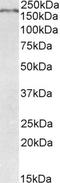 Roundabout Guidance Receptor 1 antibody, LS-B12224, Lifespan Biosciences, Western Blot image 