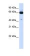 Solute Carrier Family 39 Member 4 antibody, orb330353, Biorbyt, Western Blot image 