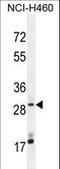 MAGI Family Member, X-Linked antibody, LS-C163973, Lifespan Biosciences, Western Blot image 