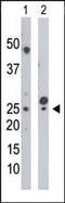 UMP-CMP kinase antibody, PA5-15419, Invitrogen Antibodies, Western Blot image 