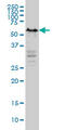 YY1 Transcription Factor antibody, 51-820, ProSci, Immunohistochemistry paraffin image 