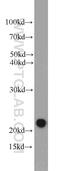 Cysteine And Glycine Rich Protein 2 antibody, 10892-2-AP, Proteintech Group, Western Blot image 