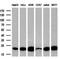 Deoxythymidylate Kinase antibody, M12209, Boster Biological Technology, Western Blot image 