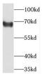 Transcobalamin 1 antibody, FNab08560, FineTest, Western Blot image 