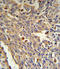 Galactosidase Alpha antibody, LS-C166494, Lifespan Biosciences, Immunohistochemistry paraffin image 