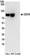 CD276 Molecule antibody, NBP2-32250, Novus Biologicals, Western Blot image 