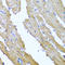 Sorcin antibody, A00222-1, Boster Biological Technology, Immunohistochemistry frozen image 