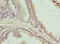 Chromosome 17 Open Reading Frame 64 antibody, orb33739, Biorbyt, Immunohistochemistry paraffin image 
