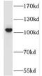 Spalt Like Transcription Factor 2 antibody, FNab07581, FineTest, Western Blot image 