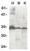TNF Receptor Superfamily Member 6b antibody, PA5-19924, Invitrogen Antibodies, Western Blot image 