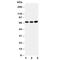 Guanylate Binding Protein 1 antibody, R30626, NSJ Bioreagents, Western Blot image 