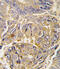 Autophagy Related 16 Like 1 antibody, A00526-2, Boster Biological Technology, Immunohistochemistry paraffin image 