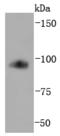Transferrin Receptor antibody, A00591-1, Boster Biological Technology, Western Blot image 
