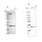 Ubiquinol-Cytochrome C Reductase, Rieske Iron-Sulfur Polypeptide 1 antibody, PA5-62172, Invitrogen Antibodies, Western Blot image 