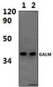 Galactose Mutarotase antibody, A07597, Boster Biological Technology, Western Blot image 