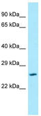 Solute Carrier Family 17 Member 1 antibody, TA338167, Origene, Western Blot image 
