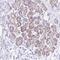 Polypyrimidine Tract Binding Protein 2 antibody, NBP1-92302, Novus Biologicals, Immunohistochemistry paraffin image 