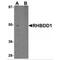 Rhomboid Domain Containing 1 antibody, MBS150674, MyBioSource, Western Blot image 