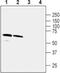 Gamma-Aminobutyric Acid Type A Receptor Alpha5 Subunit antibody, PA5-77413, Invitrogen Antibodies, Western Blot image 