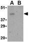 Programmed Cell Death 1 antibody, GTX31309, GeneTex, Western Blot image 