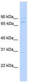 EF-Hand Domain Containing 1 antibody, TA335523, Origene, Western Blot image 