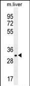 JAZF Zinc Finger 1 antibody, PA5-71566, Invitrogen Antibodies, Western Blot image 