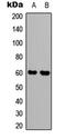 Synaptotagmin 1 antibody, LS-C358873, Lifespan Biosciences, Western Blot image 