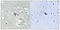 Fms Related Tyrosine Kinase 1 antibody, LS-C199719, Lifespan Biosciences, Immunohistochemistry paraffin image 
