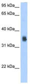 Solute Carrier Family 35 Member F2 antibody, TA333772, Origene, Western Blot image 