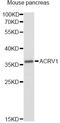 Acrosomal Vesicle Protein 1 antibody, STJ110397, St John