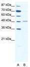 Gamma-Aminobutyric Acid Type A Receptor Alpha2 Subunit antibody, TA330434, Origene, Western Blot image 