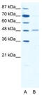 Gamma-Aminobutyric Acid Type A Receptor Alpha2 Subunit antibody, TA330434, Origene, Western Blot image 