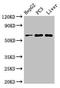 Phenylalanyl-TRNA Synthetase Subunit Beta antibody, orb53875, Biorbyt, Western Blot image 