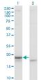 Corticotropin Releasing Hormone antibody, H00001392-M02, Novus Biologicals, Western Blot image 