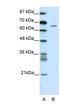 Zinc Finger Protein 205 antibody, NBP1-80302, Novus Biologicals, Western Blot image 