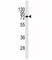 Syndecan 1 antibody, F53722-0.1ML, NSJ Bioreagents, Western Blot image 