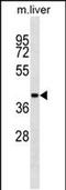 Adenosylhomocysteinase antibody, MA5-24721, Invitrogen Antibodies, Western Blot image 