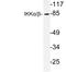 Component Of Inhibitor Of Nuclear Factor Kappa B Kinase Complex antibody, LS-C176654, Lifespan Biosciences, Western Blot image 