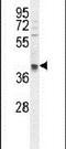 OTU Deubiquitinase 3 antibody, PA5-24508, Invitrogen Antibodies, Western Blot image 