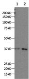 CCR4-NOT Transcription Complex Subunit 7 antibody, PA5-31139, Invitrogen Antibodies, Western Blot image 