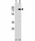 Methyl-CpG Binding Protein 2 antibody, F48100-0.4ML, NSJ Bioreagents, Western Blot image 