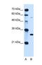 Homeostatic Iron Regulator antibody, NBP1-59055, Novus Biologicals, Western Blot image 