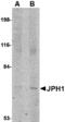 Junctophilin 1 antibody, MBS150846, MyBioSource, Western Blot image 