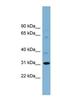 Chromosome 22 Open Reading Frame 31 antibody, NBP1-79705, Novus Biologicals, Western Blot image 