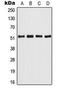 Activating Transcription Factor 2 antibody, LS-C353955, Lifespan Biosciences, Western Blot image 