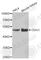 8-Oxoguanine DNA Glycosylase antibody, A2268, ABclonal Technology, Western Blot image 