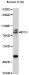 Dopamine Beta-Hydroxylase antibody, MBS127594, MyBioSource, Western Blot image 